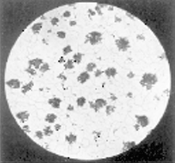 malleable iron metallography